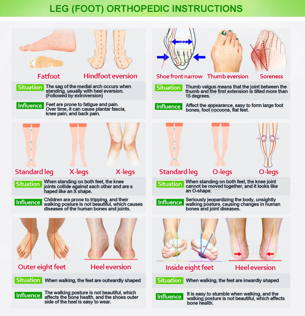 Flat Feet Template Arch Support Orthopedic Insoles,Plantar Fasciitis Heel Pain Orthotics Insoles Sneakers Shoe Inserts Men Women