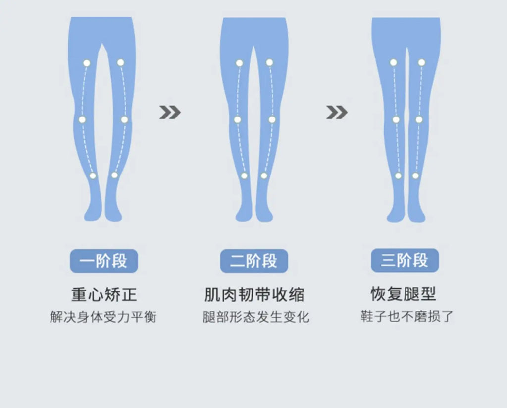 Orthotic Insoles For Flat Feet Arch Support Orthopedic Shoes Sole PU Insoles For Feet Men Women O/X Leg Corrected Care Pad