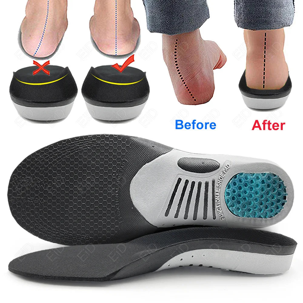 Flat Feet Template Arch Support Orthopedic Insoles,Plantar Fasciitis Heel Pain Orthotics Insoles Sneakers Shoe Inserts Men Women