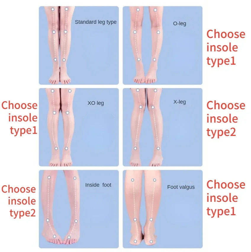 Orthotic Insoles For Flat Feet Arch Support Orthopedic Shoes Sole PU Insoles For Feet Men Women O/X Leg Corrected Care Pad